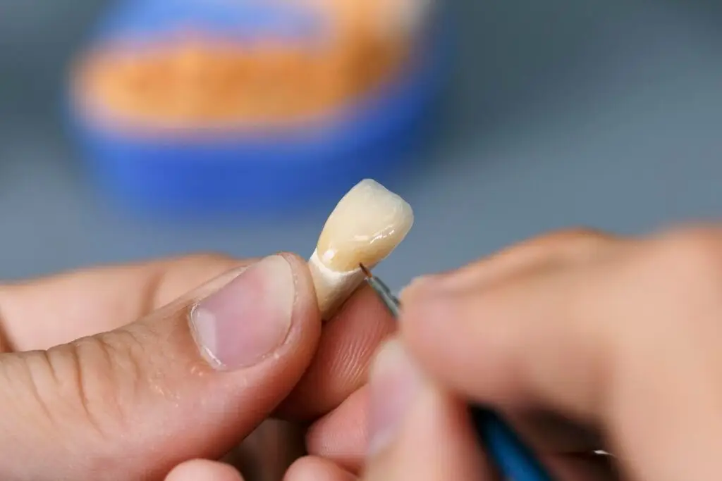 Close-up of hands crafting a porcelain veneer; ultra-thin, custom-crafted veneer to transform teeth at a dental clinic in Petaling Jaya. Aesthetic Dental Petaling Jaya porcelain veneers for natural-looking, long-lasting smile enhancement.
